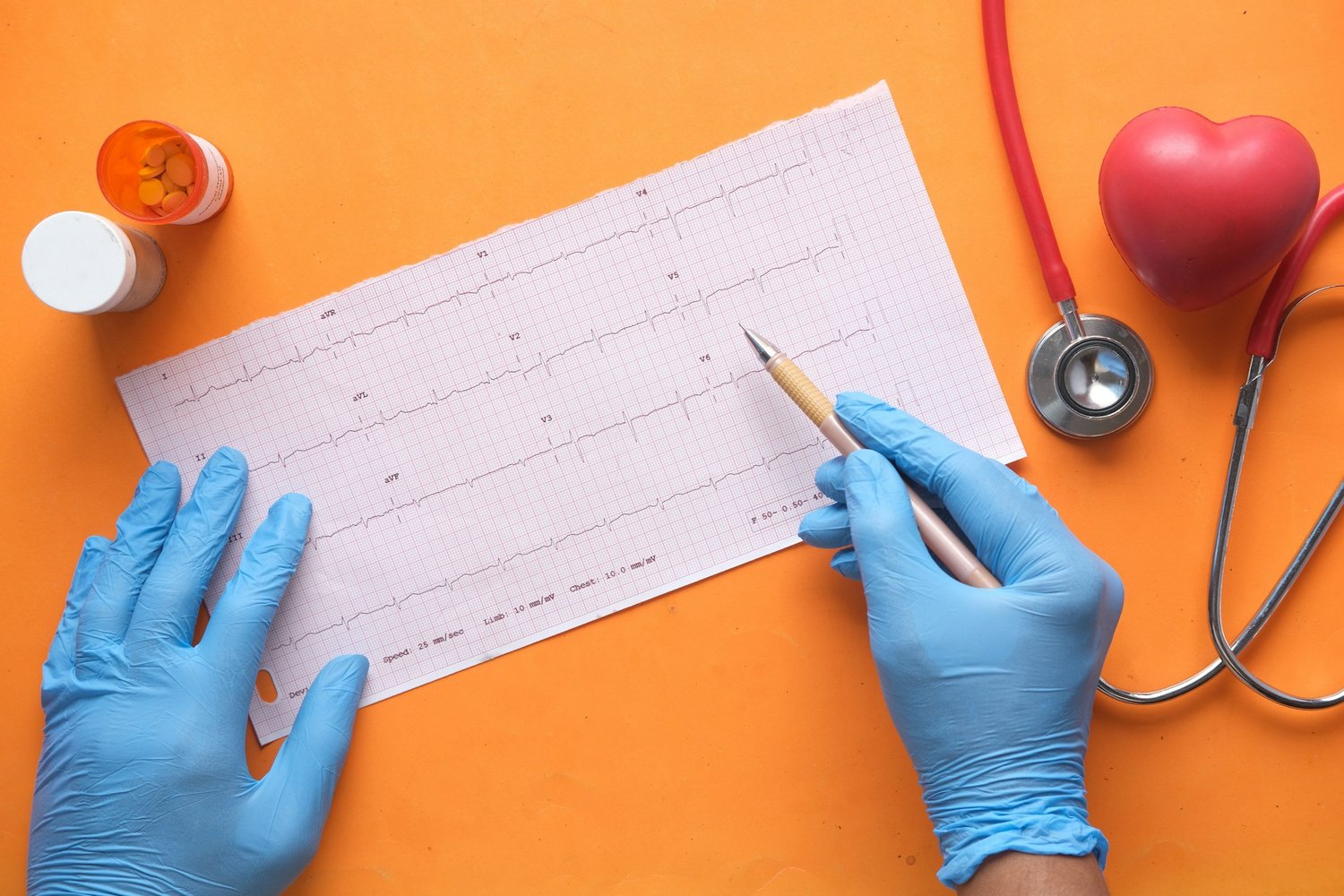 Understanding Blood Pressure Numbers: What They Mean and Why They Matter